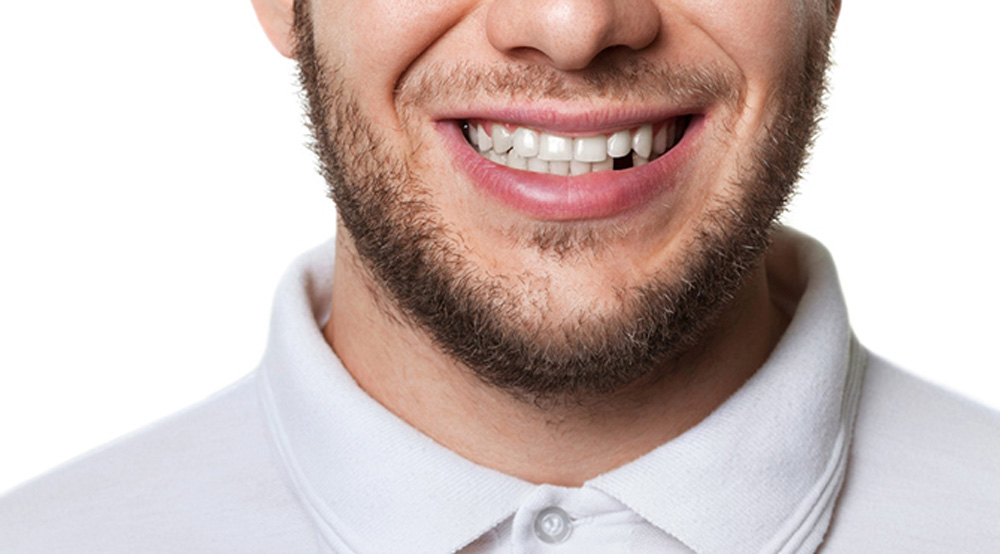 Diş Kaybı Tedavi Yöntemi