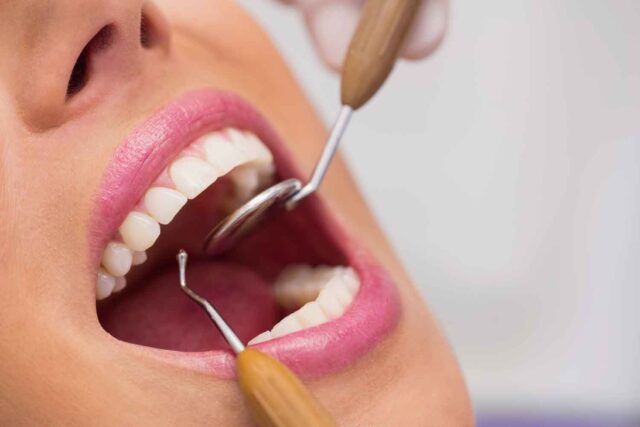 yirmilik diş tedavi 